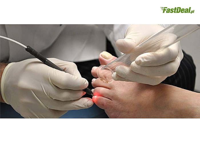 Zmiany Odczynowe Związane Z Zapaleniem łącznie Z Typową Regeneracją 29 zł zamiast 120 zł za MANICURE SPA wraz z REGENERACJĄ...