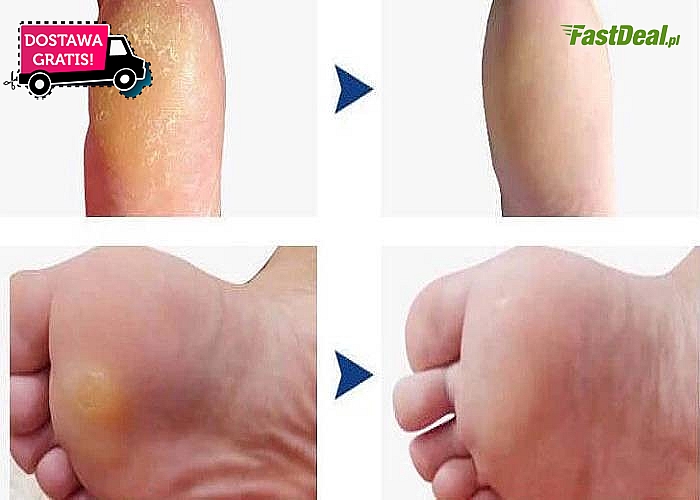 Wyjątkowo skuteczny płyn, który w łagodny sposób zmiękczy stwardniałą skórę na stopach.